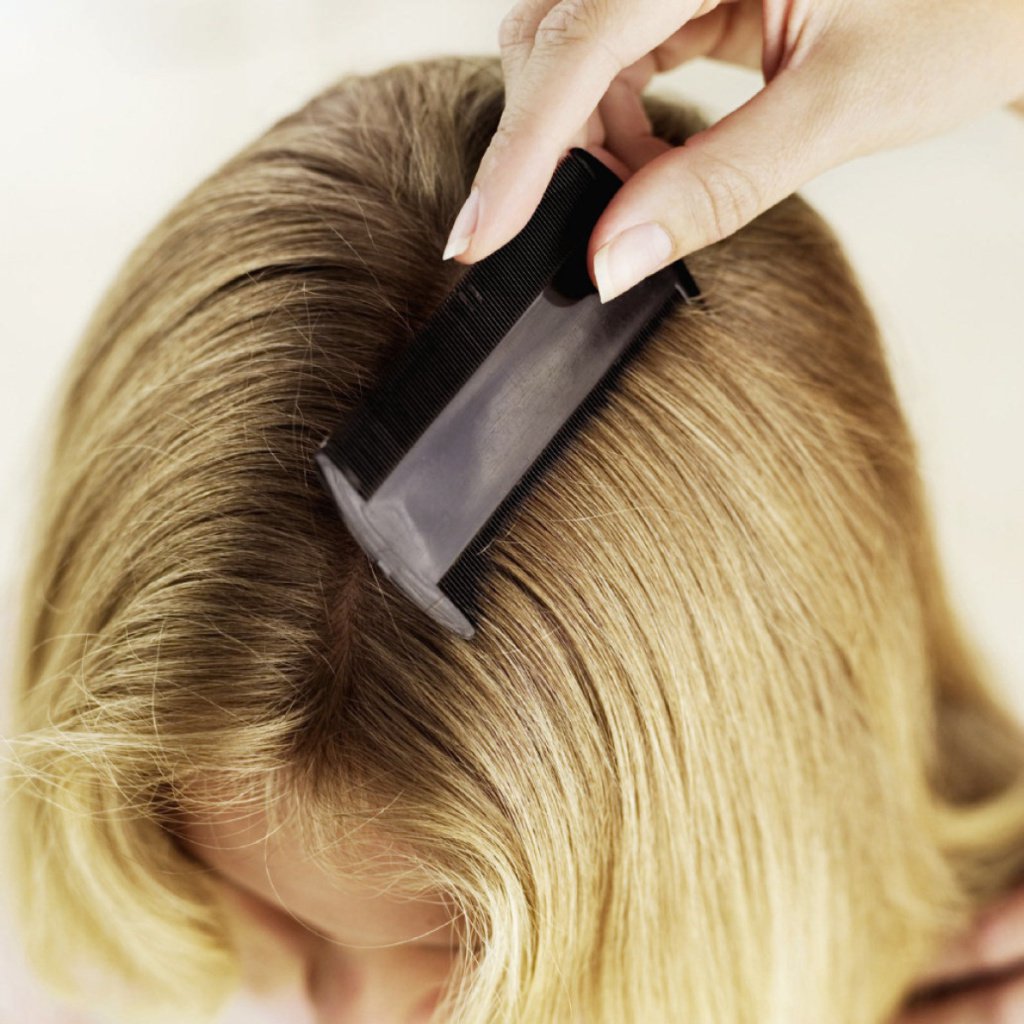 top-home-remedies-for-lice