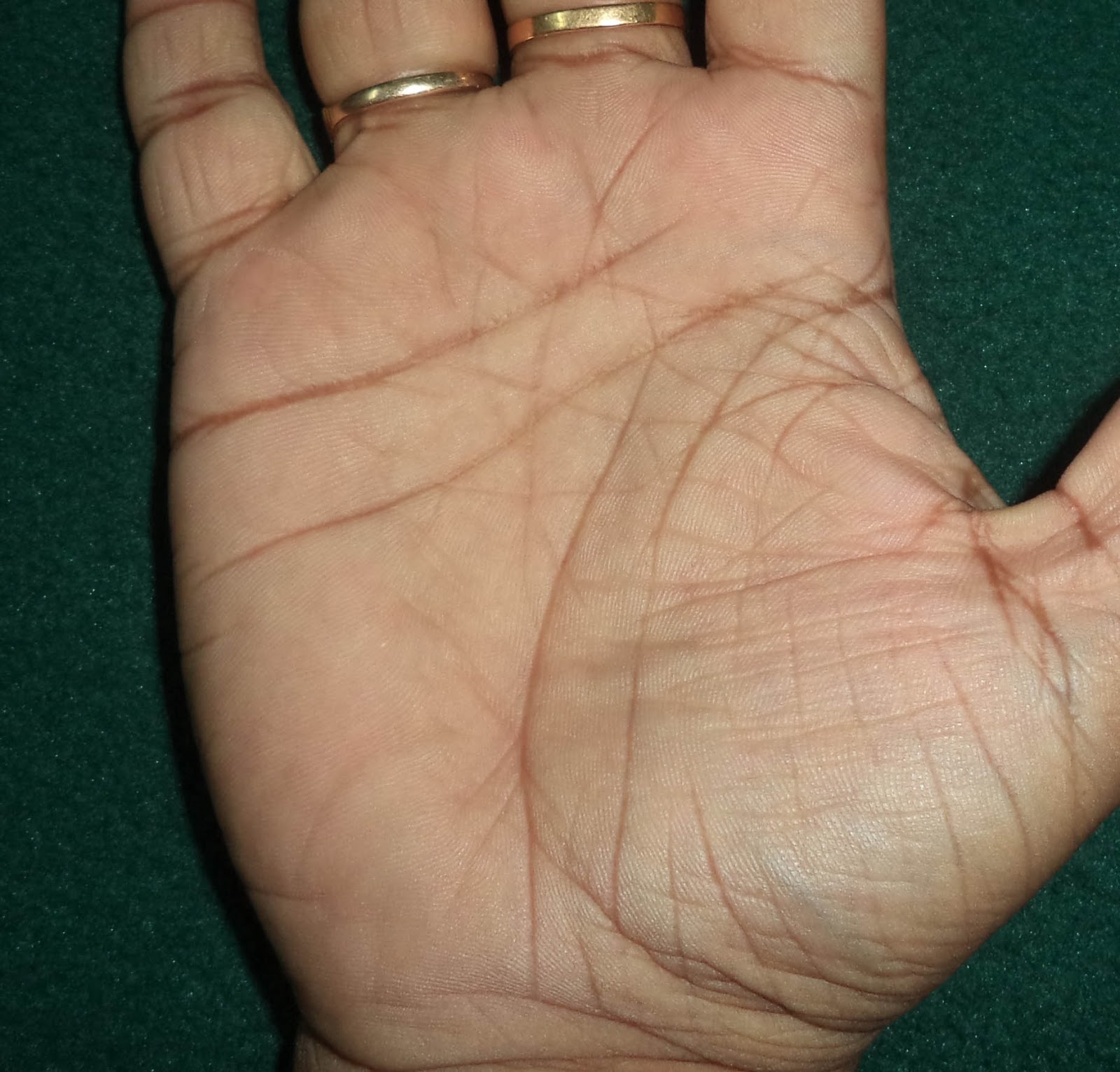 double-lifeline-palmistry