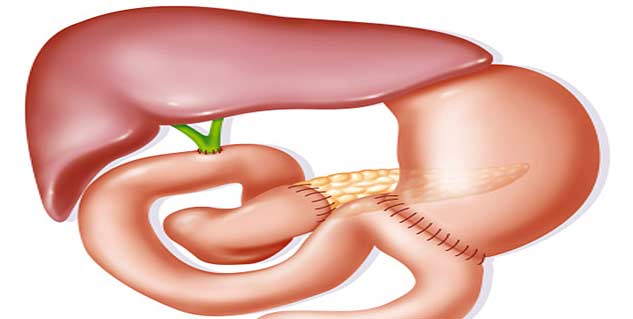 gallbladder-cancer1-633x319